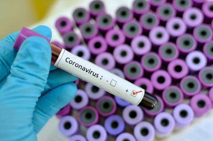 Koronavirus Türkiyədə -